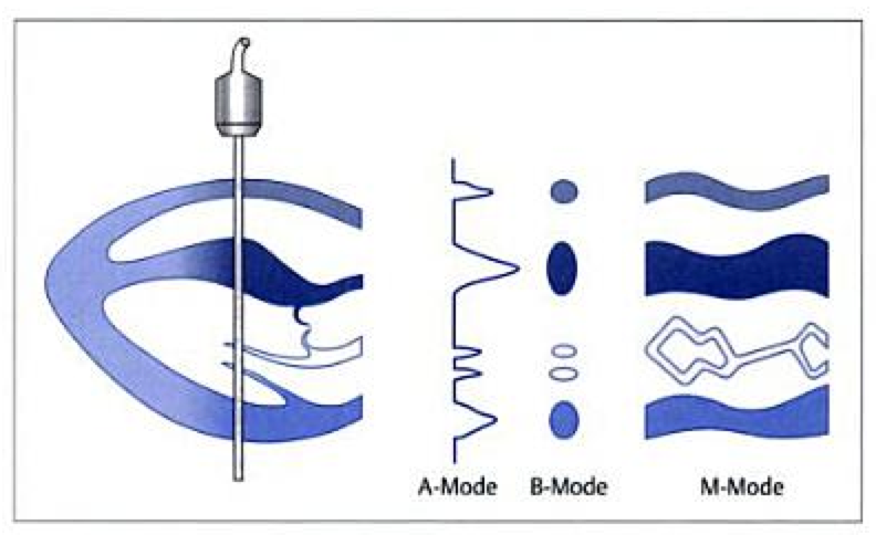 The A, B, M's – Ultrasound Modes Explained